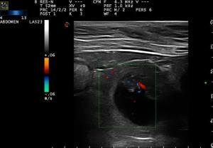 11057533_716249898511794_6142255113343183672_n